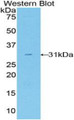 Western Blot; Sample: Recombinant TALDO1, Mouse.