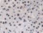 DAB staining on IHC-P; Samples: Mouse Liver Tissue; Primary Ab: 10µg/ml Rabbit Anti-Mouse TALDO1 Antibody Second Ab: 2µg/mL HRP-Linked Caprine Anti-Rabbit IgG Polyclonal Antibody