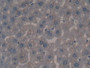 DAB staining on fromalin fixed paraffin-embedded Kidney tissue)