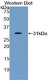 Western Blot; Sample: Recombinant protein.