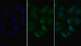 Vascular Endothelial Growth Factor Receptor 2 (Vegfr2) Polyclonal Antibody, Cat#CAU26064