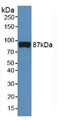 Western Blot; Sample: Rat Serum.