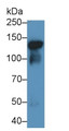 Western Blot; Sample: Recombinant protein.