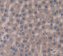 Glucokinase Regulatory Protein (Gkrp) Polyclonal Antibody, Cat#CAU26071