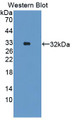 Western Blot; Sample: Recombinant protein.