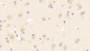 DAB staining on IHC-P; Samples: Human Cerebrum Tissue;  Primary Ab: 20μg/ml Rabbit Anti-Human ASM Antibody Second Ab: 2µg/mL HRP-Linked Caprine Anti-Rabbit IgG Polyclonal Antibody 