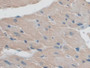 DAB staining on IHC-P; Samples: Mouse Heart Tissue; Primary Ab: 20µg/ml Rabbit Anti-Mouse ASK1 Antibody Second Ab: 2µg/mL HRP-Linked Caprine Anti-Rabbit IgG Polyclonal Antibody