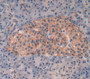 Apoptosis Signal Regulating Kinase 1 (Ask1) Polyclonal Antibody, Cat#CAU26084