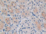 DAB staining on IHC-P; Samples: Rat Kidney Tissue; Primary Ab: 10µg/ml Rabbit Anti-Rat ALOX15B Antibody Second Ab: 2µg/mL HRP-Linked Caprine Anti-Rabbit IgG Polyclonal Antibody