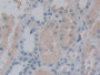 DAB staining on IHC-P; Samples: Human Kidney Tissue; Primary Ab: 10µg/ml Rabbit Anti-Human ALOX15B Antibody Second Ab: 2µg/mL HRP-Linked Caprine Anti-Rabbit IgG Polyclonal Antibody