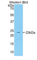 Western Blot; Sample: Recombinant protein.