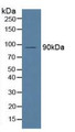 Western Blot; Sample: Human Serum.