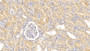 DABstainingonIHC-P.Samples:HumanTissue)