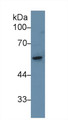 Western Blot; Sample: Rat Small intestine lysate; Primary Ab: 1µg/ml Rabbit Anti-Rat KRT8 Antibody Second Ab: 0.2µg/mL HRP-Linked Caprine Anti-Rabbit IgG Polyclonal Antibody