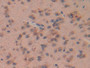 DAB staining on IHC-P; Samples: Mouse Brain Tissue)