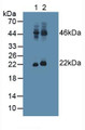 Western Blot; Sample: Lane1: Human Cerebellum Tissue; Lane2: Human Testis Tissue.