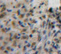 Used in DAB staining on fromalin fixed paraffin-embedded Ovary tissue