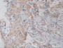 DAB staining on IHC-P; Samples: Human Stomach Tissue.