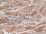 Figure. DAB staining on IHC-P; Samples：Human Esophagus Tissue.