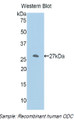 Western Blot; Sample: Recombinant protein.