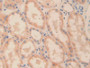 DAB staining on IHC-P; Samples: Human Kidney Tissue; Primary Ab: 30µg/ml Rabbit Anti-Human ODC Antibody Second Ab: 2µg/mL HRP-Linked Caprine Anti-Rabbit IgG Polyclonal Antibody