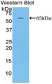 Western Blot; Sample: Recombinant protein.