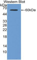 Western Blot; Sample: Recombinant protein.