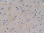 DAB staining on IHC-P; Samples: Mouse Cerebrum Tissue;  Primary Ab: 30µg/ml Rabbit Anti-Mouse MAP2 A