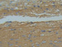 DAB staining on IHC-P; Samples: Rat Brain Tissue;  Primary Ab: 10µg/ml Rabbit Anti-Rat GAP43 Antibod