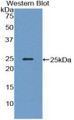 Western Blot; Sample: Recombinant protein.