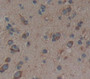 Neurofilament 3 (Nef3) Polyclonal Antibody, Cat#CAU26137