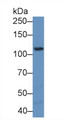 Western Blot; Sample: Mouse Cerebrum lysate; Primary Ab: 1µg/ml Rabbit Anti-Mouse PTK2b Antibody Second Ab: 0.2µg/mL HRP-Linked Caprine Anti-Rabbit IgG Polyclonal Antibody