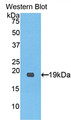 Western Blot; Sample: Recombinant protein.