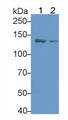 Western Blot; Sample: Lane1: Hela cell lysate; Lane2: HepG2 cell lysate; Primary Ab: 1μg/ml Rabbit Anti-Human ITGa1 Antibody; Second Ab: 0.2µg/mL HRP-Linked Caprine Anti-Rabbit IgG Polyclonal Antibody;