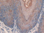 DAB staining on IHC-P; Samples: Mouse Esophagus Tissue; Primary Ab: 30µg/ml Rabbit Anti-Mouse SLPI Antibody Second Ab: 2µg/mL HRP-Linked Caprine Anti-Rabbit IgG Polyclonal Antibody