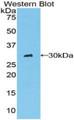 Western Blot; Sample: Recombinant protein.