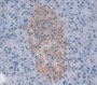 Chymotrypsin C (Ctrc) Polyclonal Antibody, Cat#CAU26169