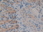 DAB staining on fromalin fixed paraffin- embedded stomach tissue)