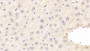 DAB staining on IHC-P; Samples: Mouse Liver Tissue;  Primary Ab: 20μg/ml Rabbit Anti-Mouse C8b Antibody Second Ab: 2µg/mL HRP-Linked Caprine Anti-Rabbit IgG Polyclonal Antibody 