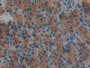 DAB staining on fromalin fixed paraffin- embedded stomach tissue)