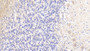 DAB staining on IHC-P; Samples: Human Cerebellum Tissue; Primary Ab: 20μg/ml Rabbit Anti-Human AGRN Antibody Second Ab: 2µg/mL HRP-Linked Caprine Anti-Rabbit IgG Polyclonal Antibody