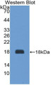 Western Blot; Sample: Recombinant protein.