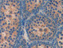 DAB staining on IHC-P; Samples: Mouse Testis Tissue; Primary Ab: 30µg/ml Rabbit Anti-Mouse AGRP Antibody Second Ab: 2µg/mL HRP-Linked Caprine Anti-Rabbit IgG Polyclonal Antibody