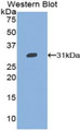 Western Blot; Sample: Recombinant protein.