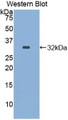 Western Blot; Sample: Recombinant protein.