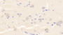 DAB staining on IHC-P; Samples: Human Cerebrum Tissue;  Primary Ab: 20μg/ml Rabbit Anti-Human PTPRS Antibody Second Ab: 2µg/mL HRP-Linked Caprine Anti-Rabbit IgG Polyclonal Antibody 