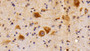 DAB staining on IHC-P; Samples: Rat Cerebellum Tissue; Primary Ab: 10μg/ml Rabbit Anti-Rat CTSD Antibody Second Ab: 2µg/mL HRP-Linked Caprine Anti-Rabbit IgG Polyclonal Antibody