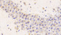 DAB staining on IHC-P; Samples: Mouse Cerebellum Tissue; Primary Ab: 20μg/ml Rabbit Anti-Mouse CTSD Antibody Second Ab: 2µg/mL HRP-Linked Caprine Anti-Rabbit IgG Polyclonal Antibody