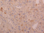 DAB staining on IHC-P; Samples: Human Liver Tissue; Primary Ab: 20µg/ml Rabbit Anti-Human CTSD Antibody Second Ab: 2µg/mL HRP-Linked Caprine Anti-Rabbit IgG Polyclonal Antibody