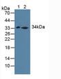 Western Blot; Sample: Lane1: Mouse Liver Tissue; Lane2: Rat Liver Tissue.